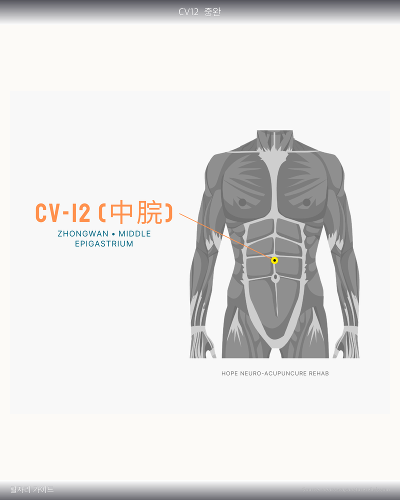 CV12 혈자리 위치 그림