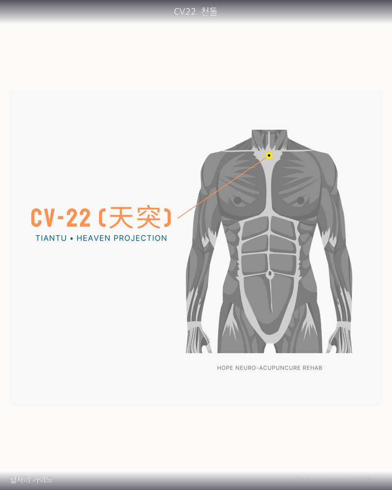 CV22 혈자리 위치 그림