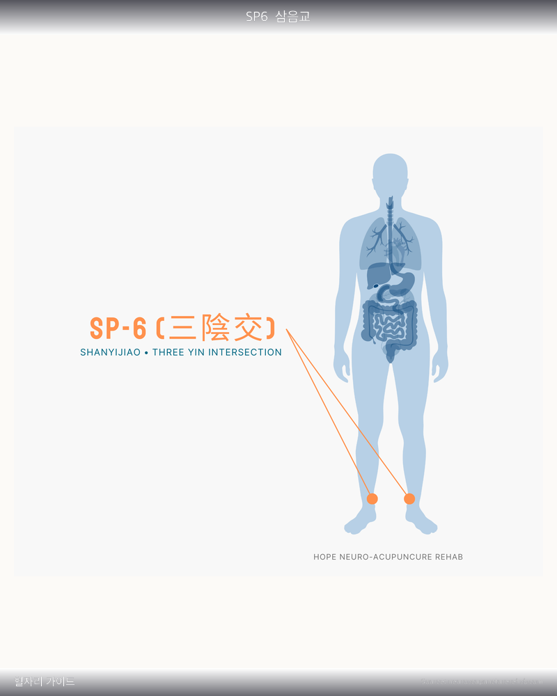 SP6 혈자리 위치 그림